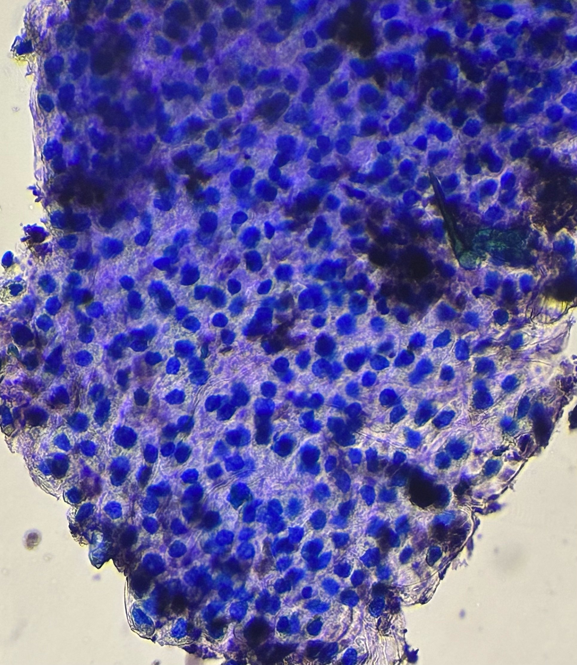 Cells stained with both Toluidine Blue O and Methylene Blue at 400x