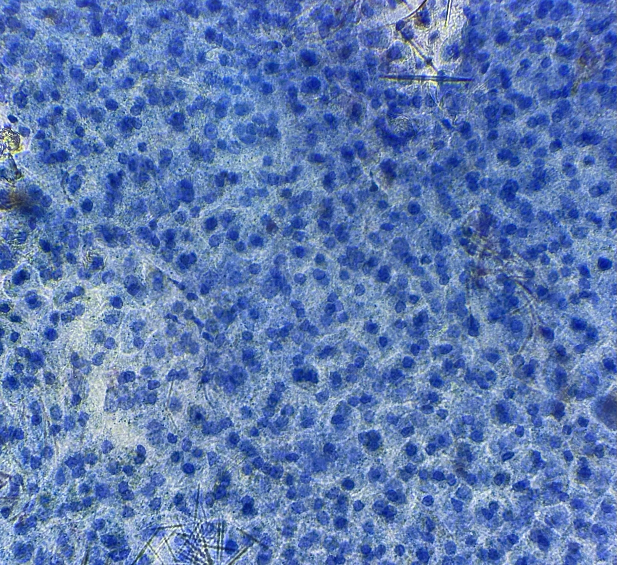 Meristematic orchid cells stained with Toluidine Blue O at 400x