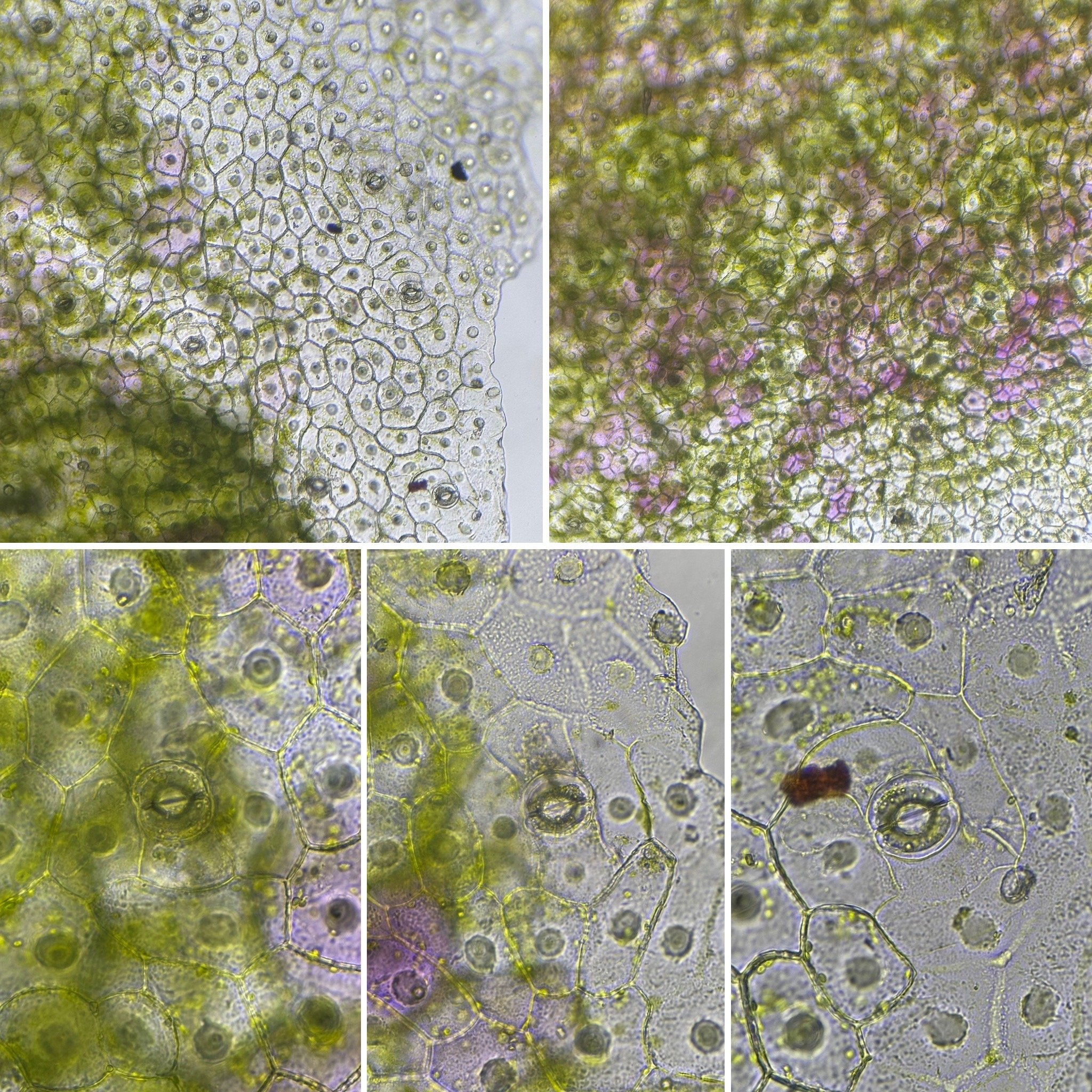 Phalaenopsis orchid epidermal pavement cells and stomata  at 100x/400x