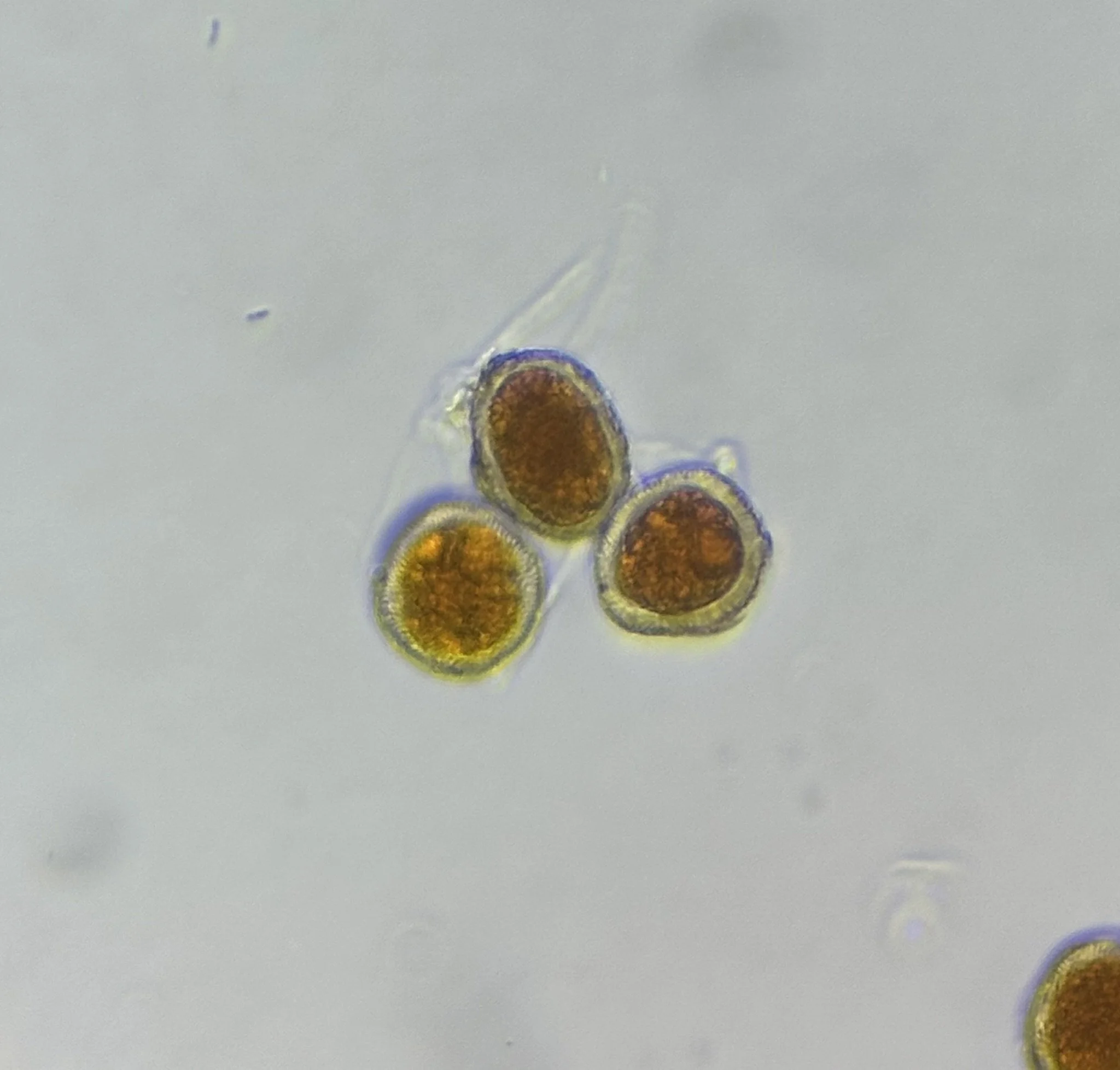Spores showing an outer wall or episporium at 400x
