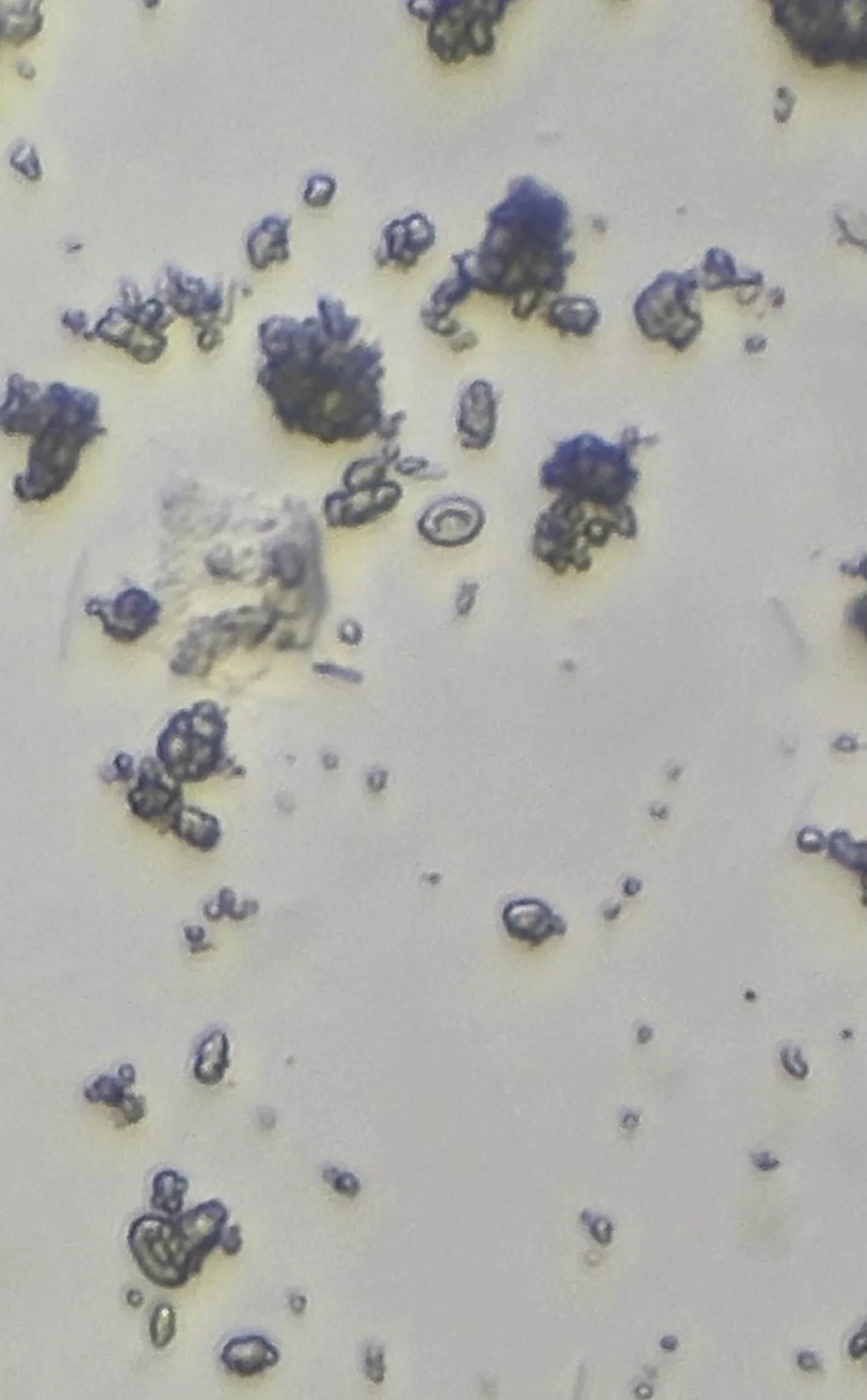 Coccolithophore armor or calcareous plates (coccoliths) at 400x