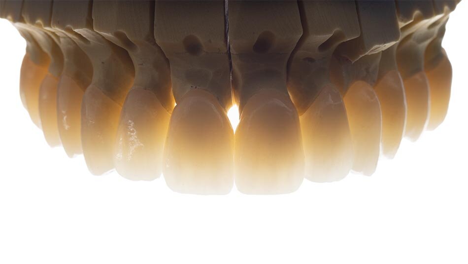 Replacement Crowns _0001_Backlight.jpg