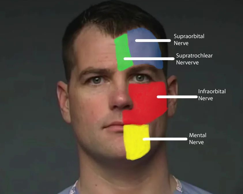 Nerve Blocks of the Face and Mouth — Downeast Emergency Medicine