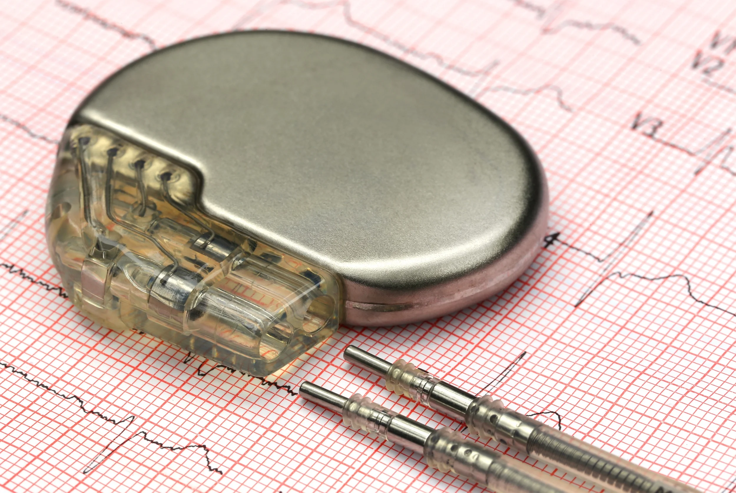 What the Heck is Going on with this Pacemaker?!
