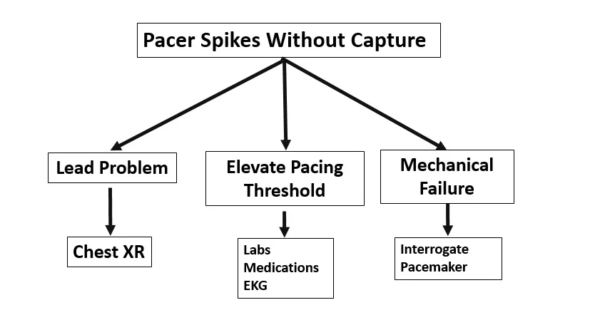 What the Heck is Going on with this Pacemaker?! — Downeast Emergency ...