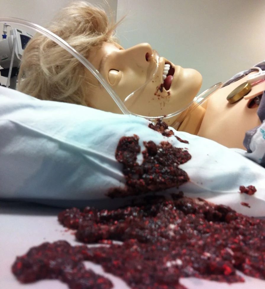 Upper GI Bleed.jpg