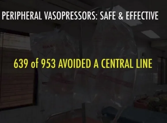 Peripheral vasopressors safe and effective.jpg