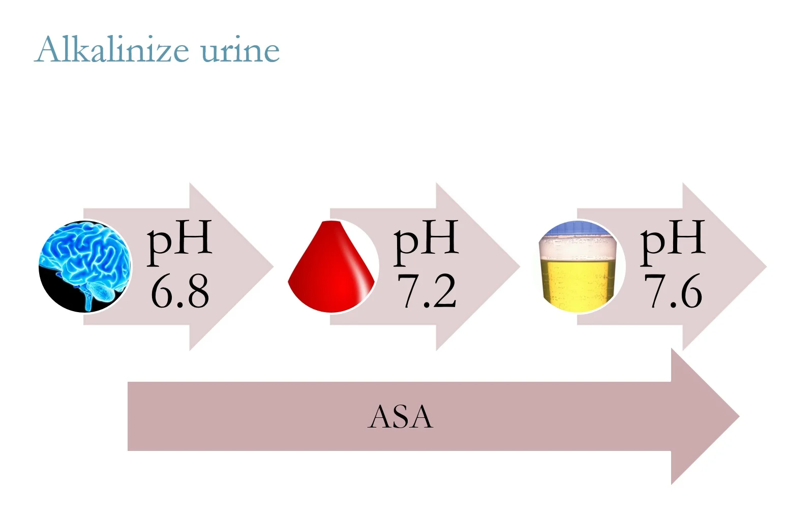 When urine is alkalinized, aspirin gets trapped in urine, setting up concentration gradient decreasing amount in brain (graphic by tammi schaeffer)