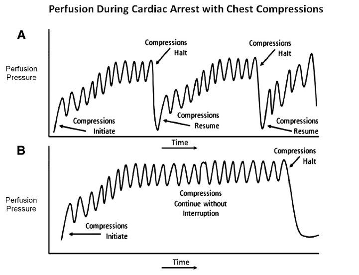 cunningham cpr.png