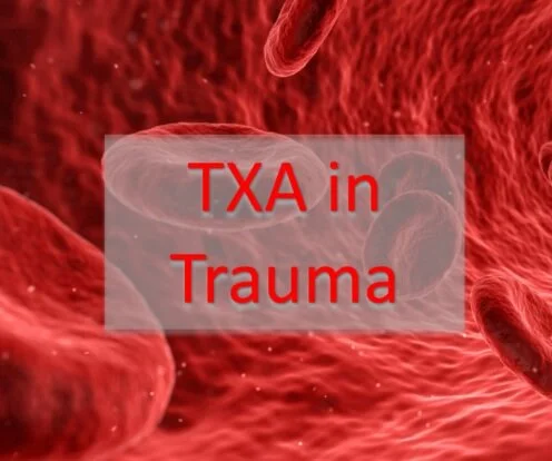 Journal Club - Tranexamic Acid in Trauma