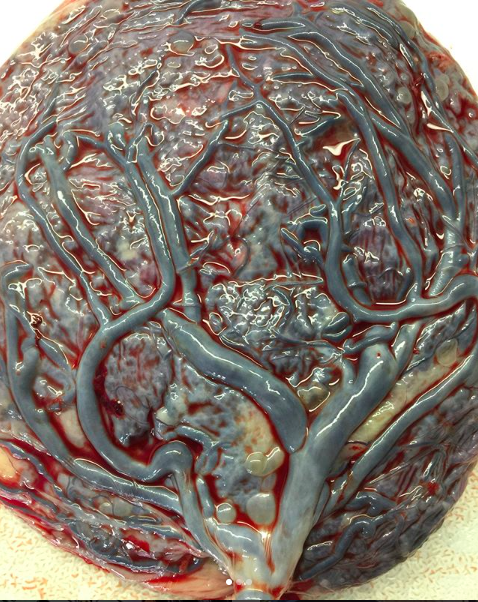 Placenta