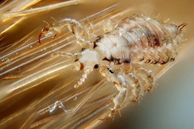 A hair louse. Gross, right? Photo from wikipedia.