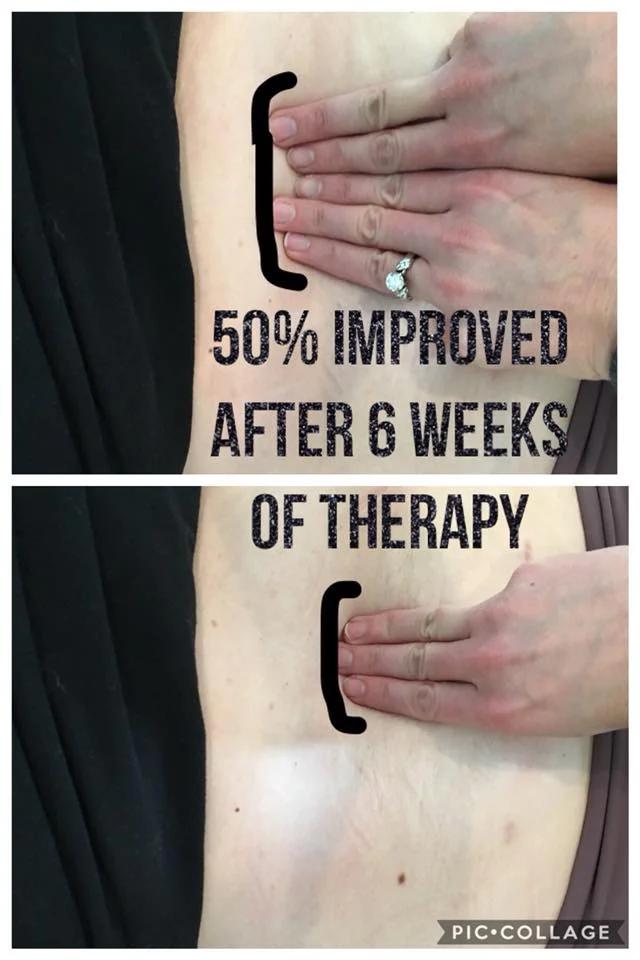 Women’s Health Diastasis Recti Wake Forest North Carolina