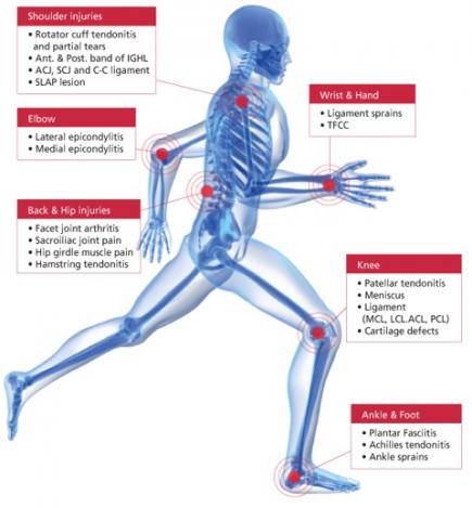 Via 3dsportsmed.com
