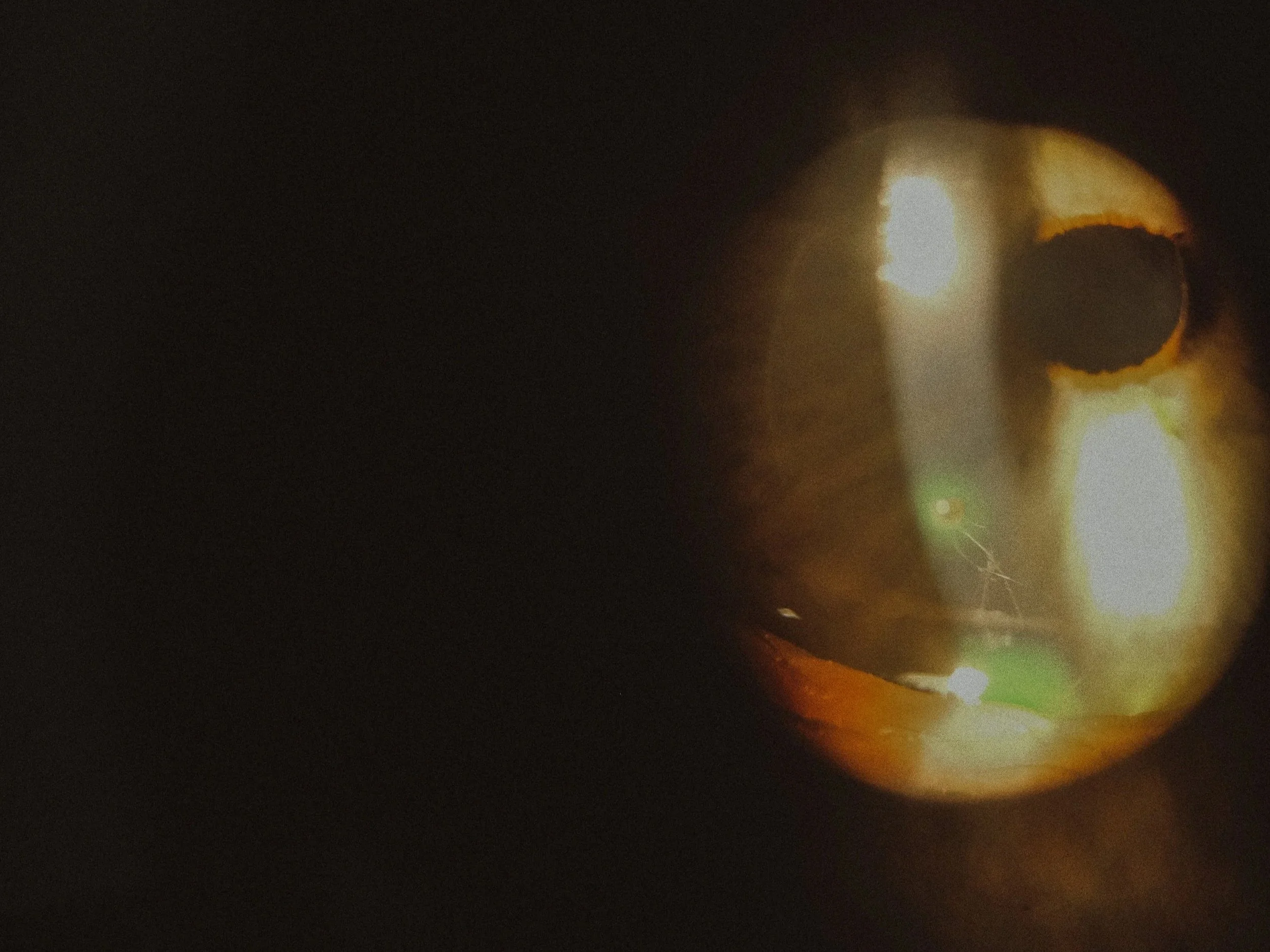 zoomed in view of metal in eye