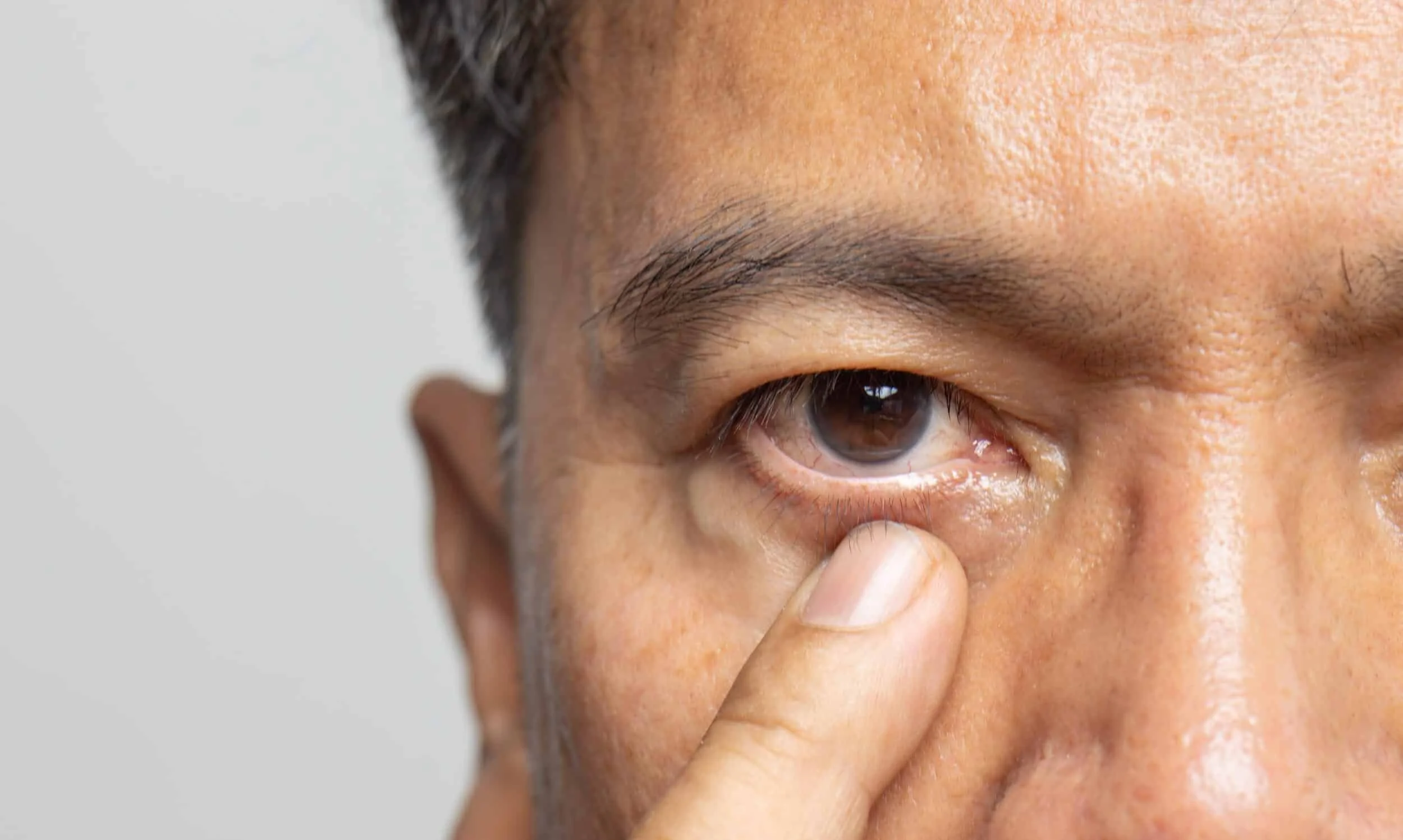 Why Does My Eye Twitch Randomly?