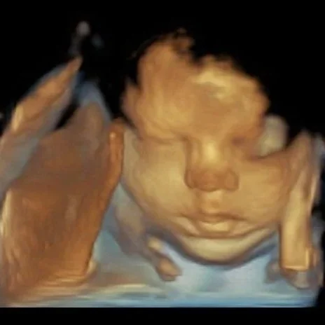 4d baby ultrasound image