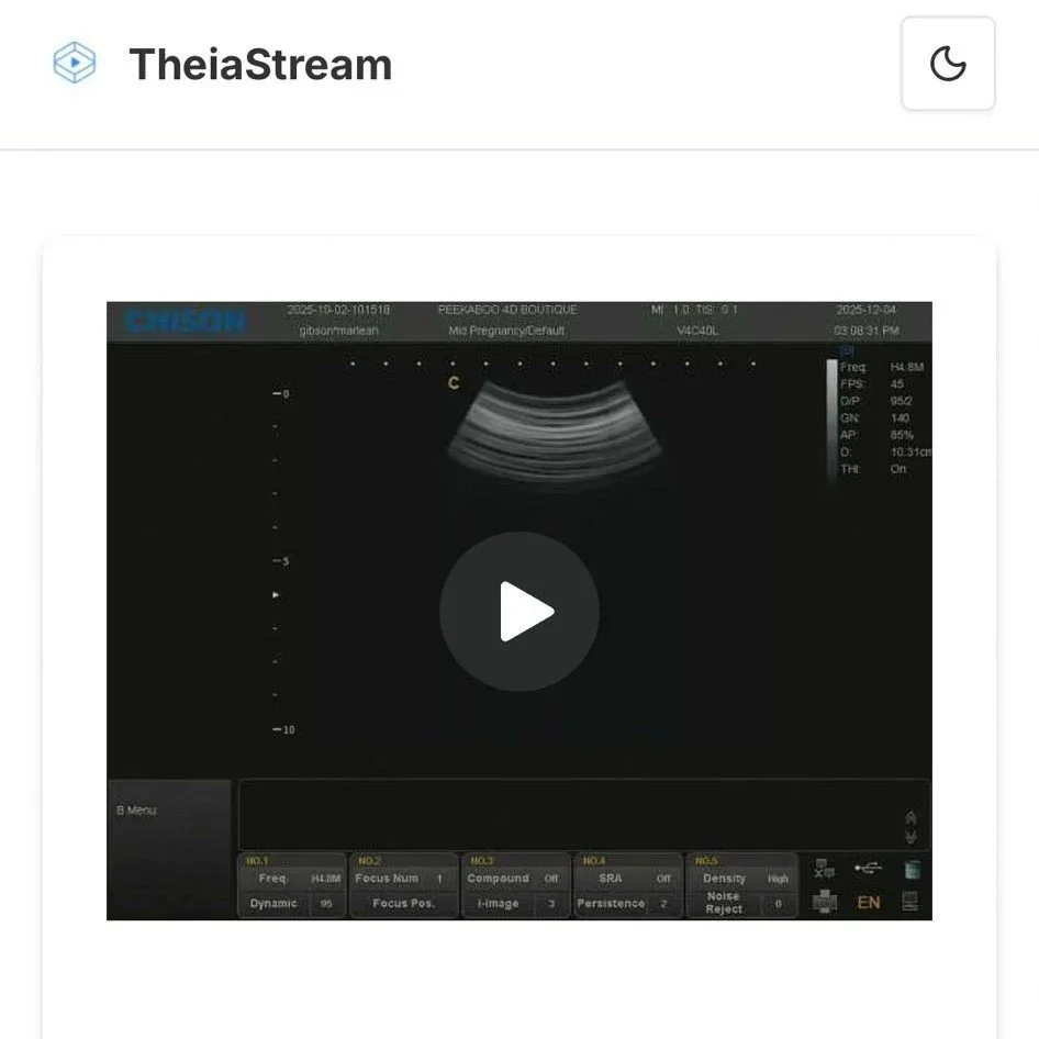 TheiaStream black and white ultrasound image
