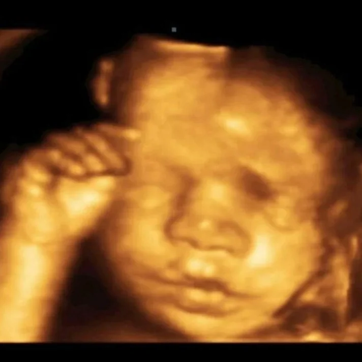 3d baby ultrasound picture