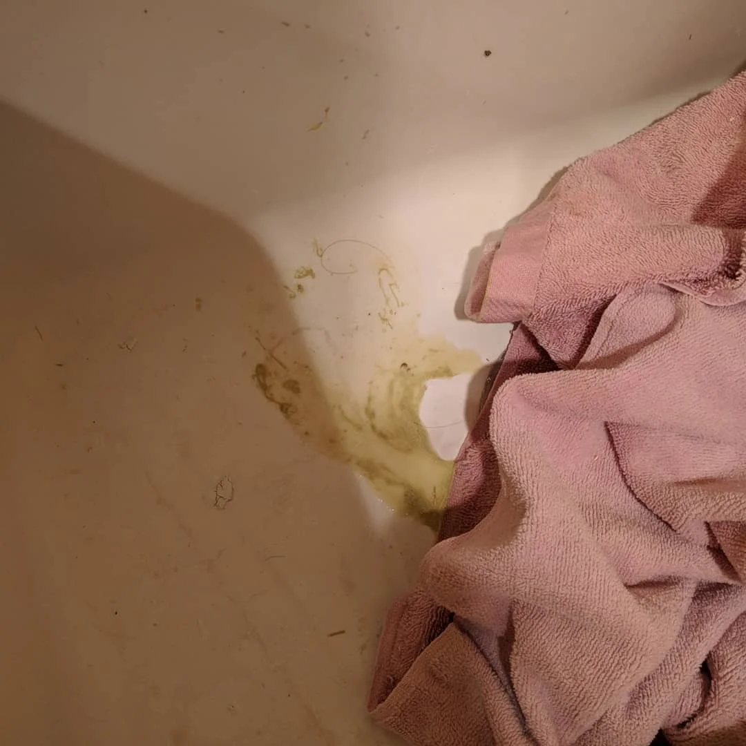This is what her poop looked like. Not normal at all.
