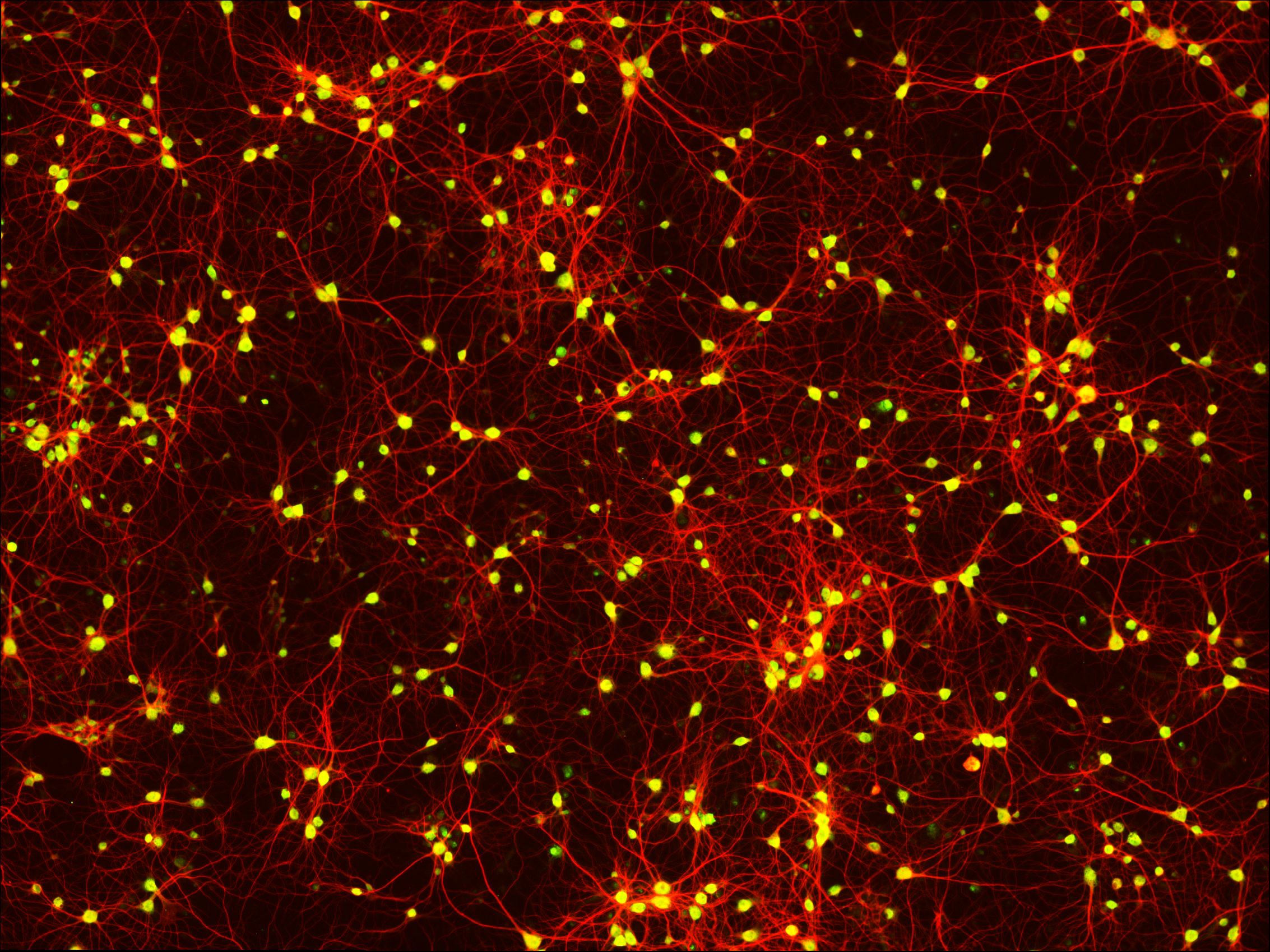 5 Primary neurons Map2 NeuN AOrr 2019.jpg