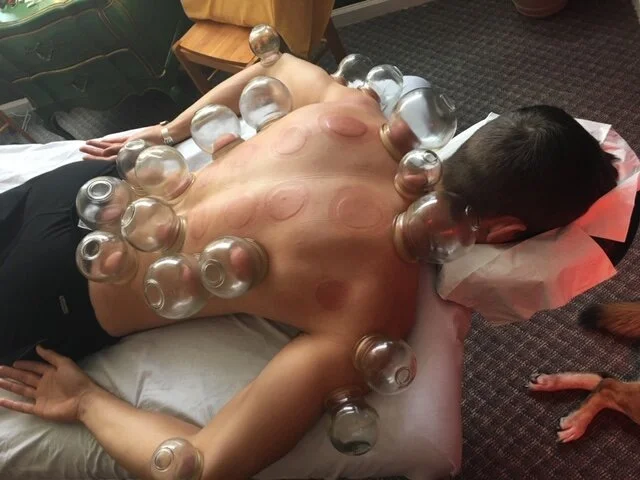 CUPPINGPIC.JPG