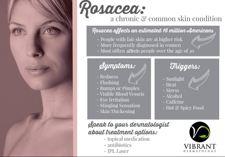 best prescription cream for rosacea