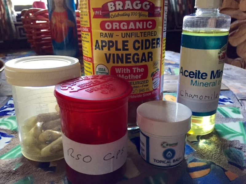 My before and aftercare (l to R): Chamomile concentrate caps w/coconut oil; rso caps w/coconut oil; xternal salve for topical on affected area; mineral oil infused with chamomile; and apple cider vinegar infused with chamomile. Photo: sharon letts
