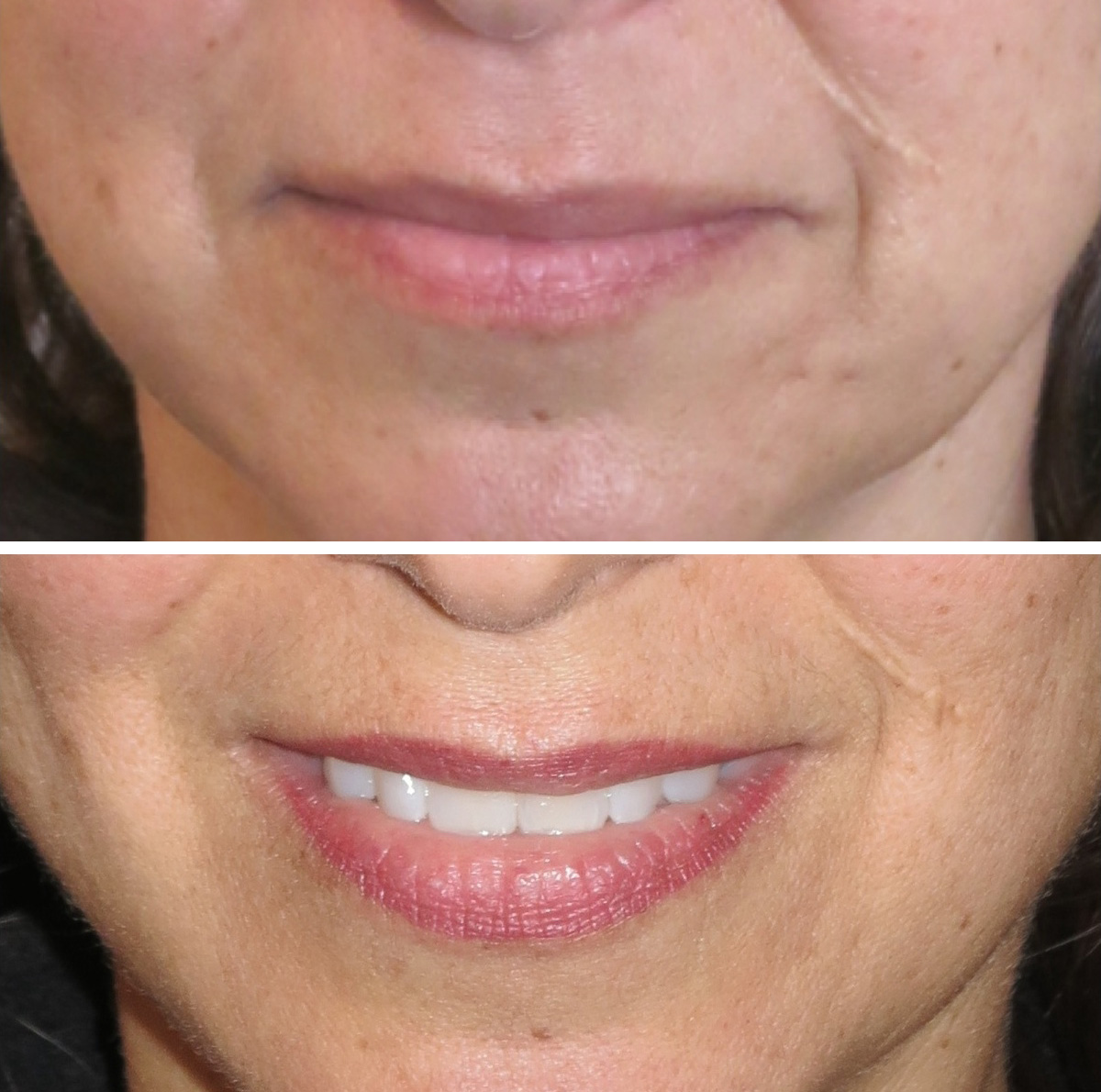 30 days healed before retouched blended lip liner