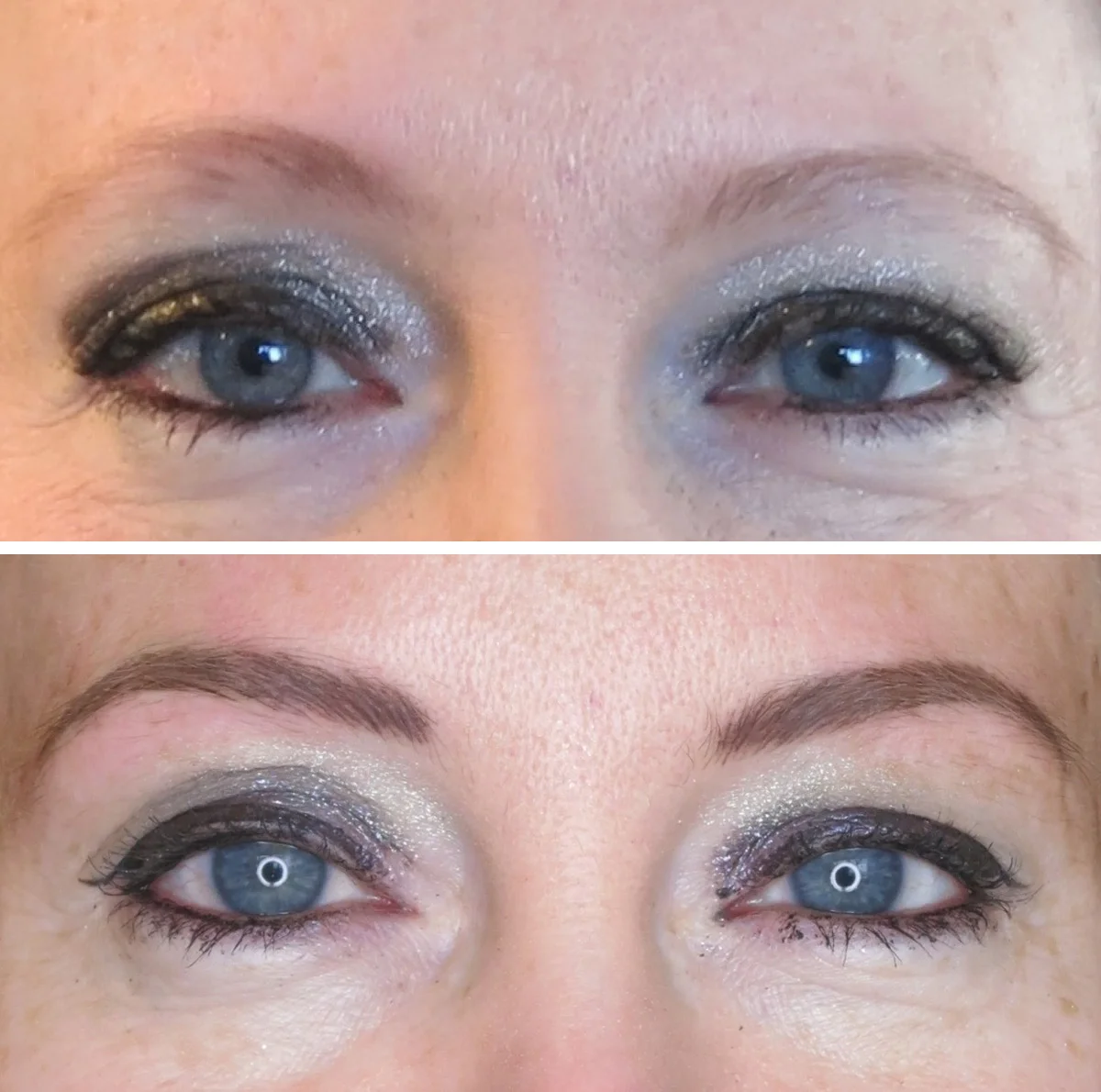 30 days healed prior to follow up