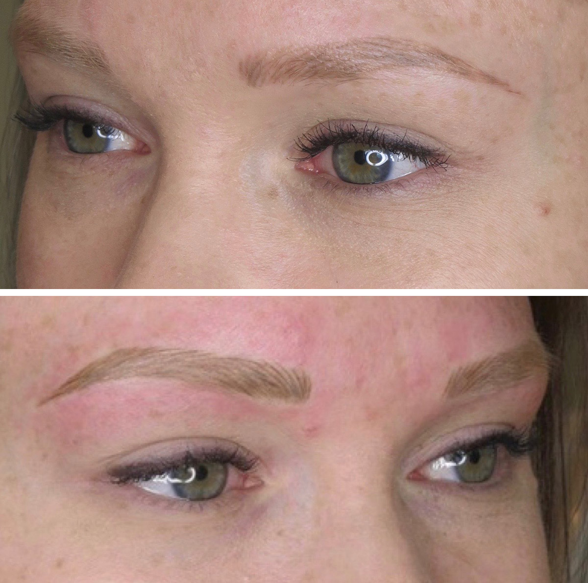 Above shows 30 days healed after first service and below is directly after follow up.