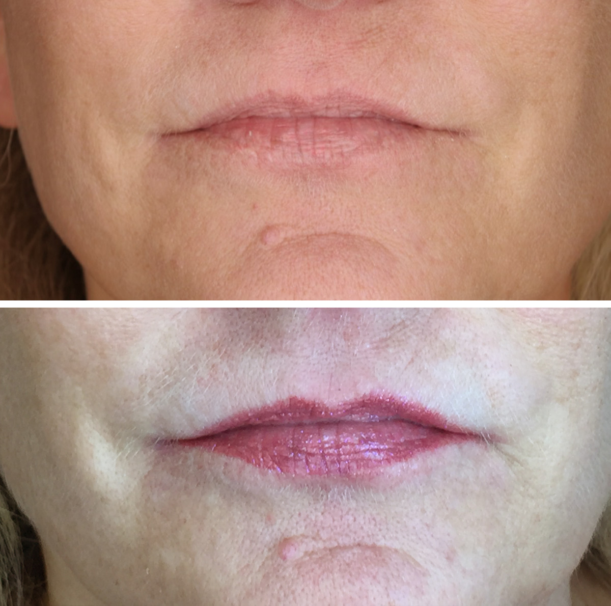 90 days after 2nd service full lip tint