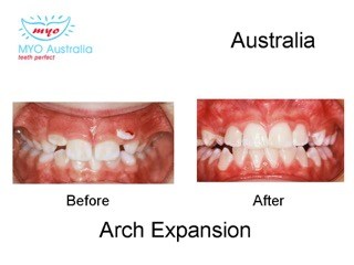 150-arch-Expansion-Australia-myomunchee.jpeg