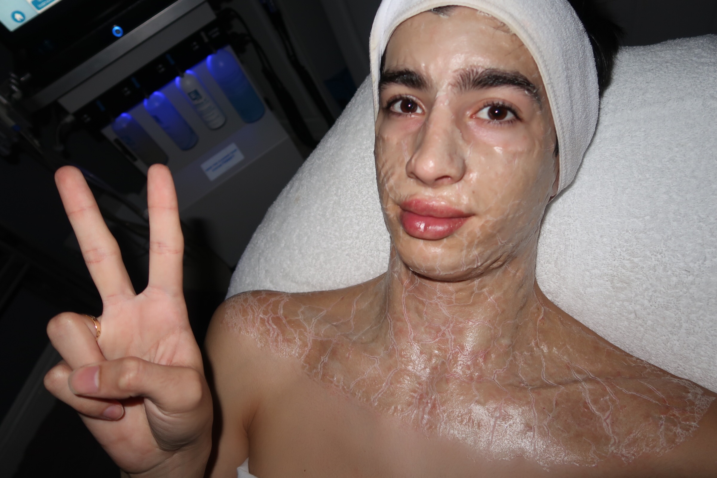 25 minutes with the mask on. (smiling on the inside)