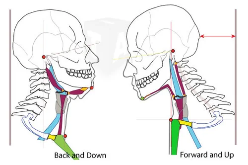 Forward Head Posture — The Mechanics of Poise