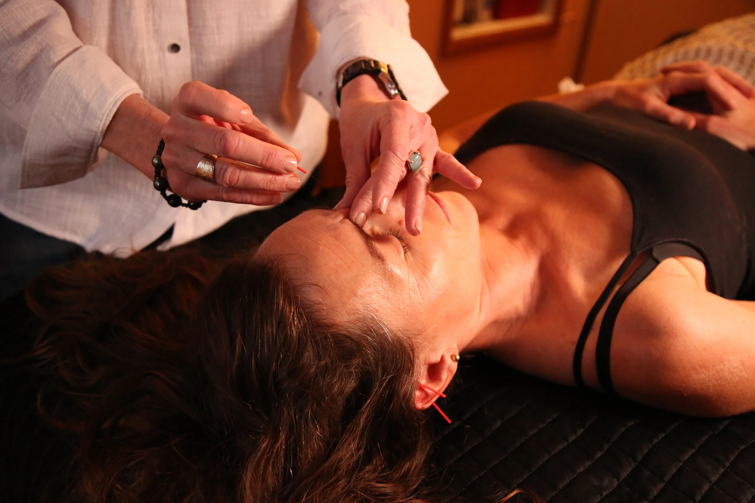 Acupuncture and Fertility by Geina Horton L.Ac., Dipl. Ac.