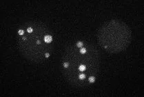 RNAi_nuclei.jpg