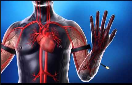 BFR can be utilized on the arms or legs.