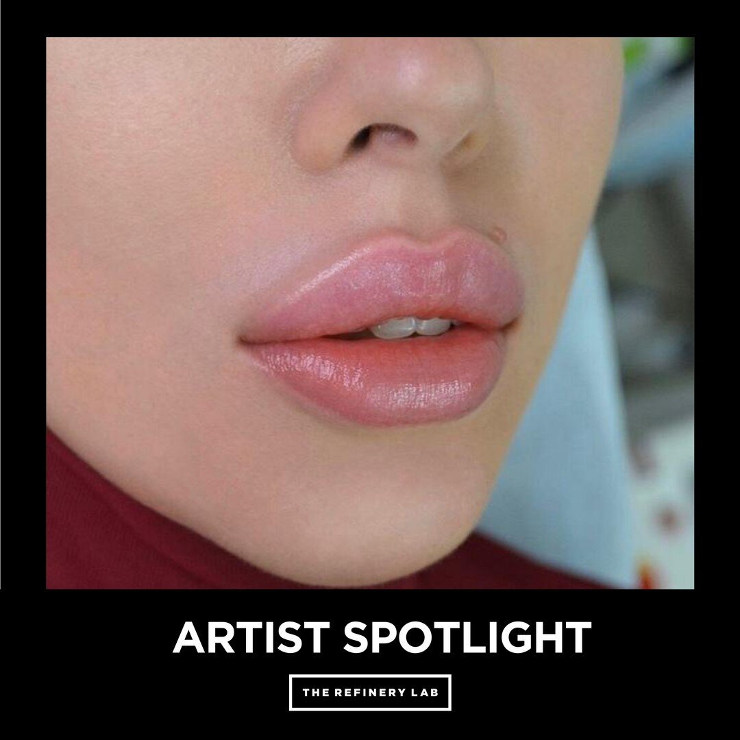 ARTIST SPOTLIGHT: Look at this beautiful shape! This lip filler was done by injector @med_yu_med⠀⠀⠀⠀⠀⠀⠀⠀⠀
⠀⠀⠀⠀⠀⠀⠀⠀⠀
Lip filler is a cosmetic procedure that will give you enhanced, fuller, and plumper lips! They last 6-12 months depending on the lifes