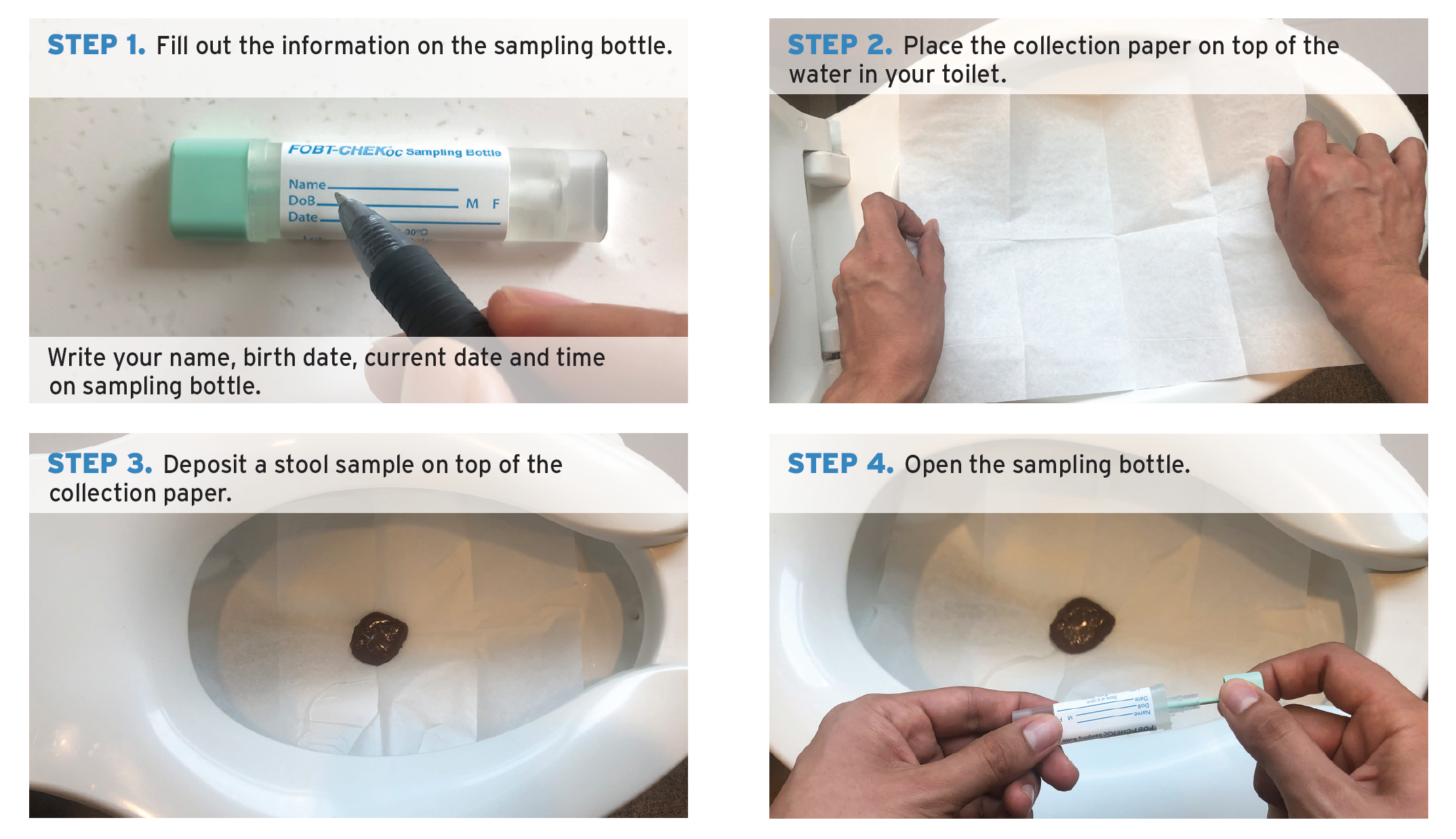 Colon Cancer Stool Test Colon Cancer Stool Test
