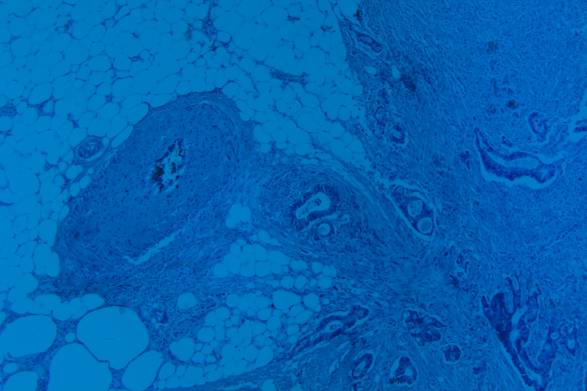 colon-image.jpg