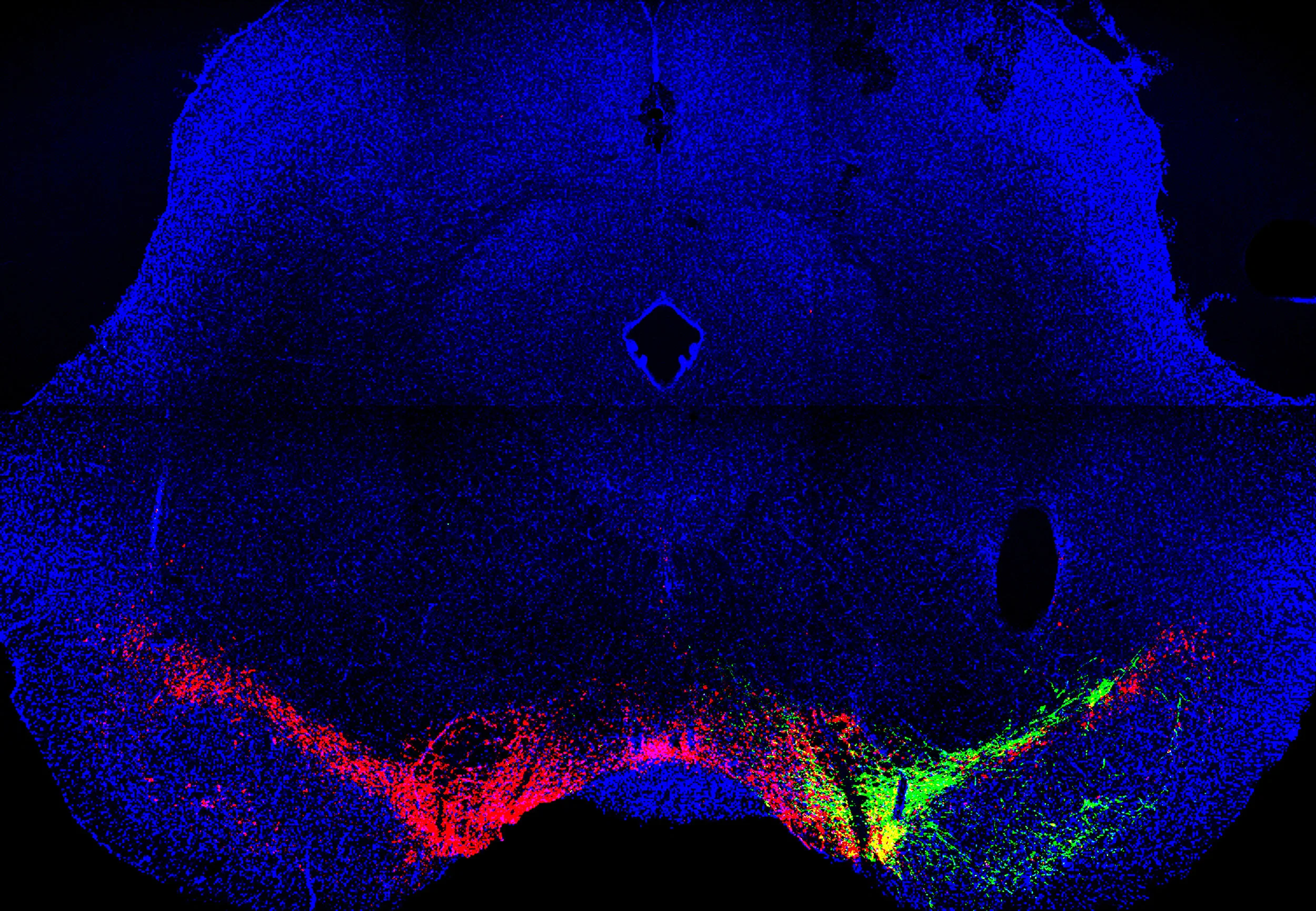 RetroSNC_TH+GFP.jpg