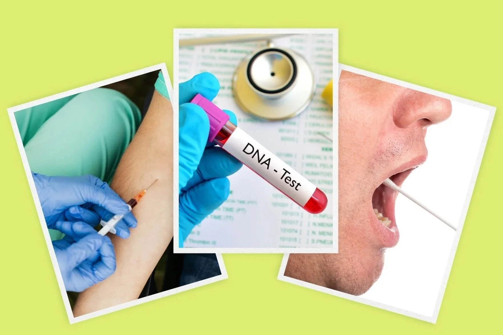 Non Invasive DNA Paternity Testing Tampa | Prenatal Paternity DNA ...