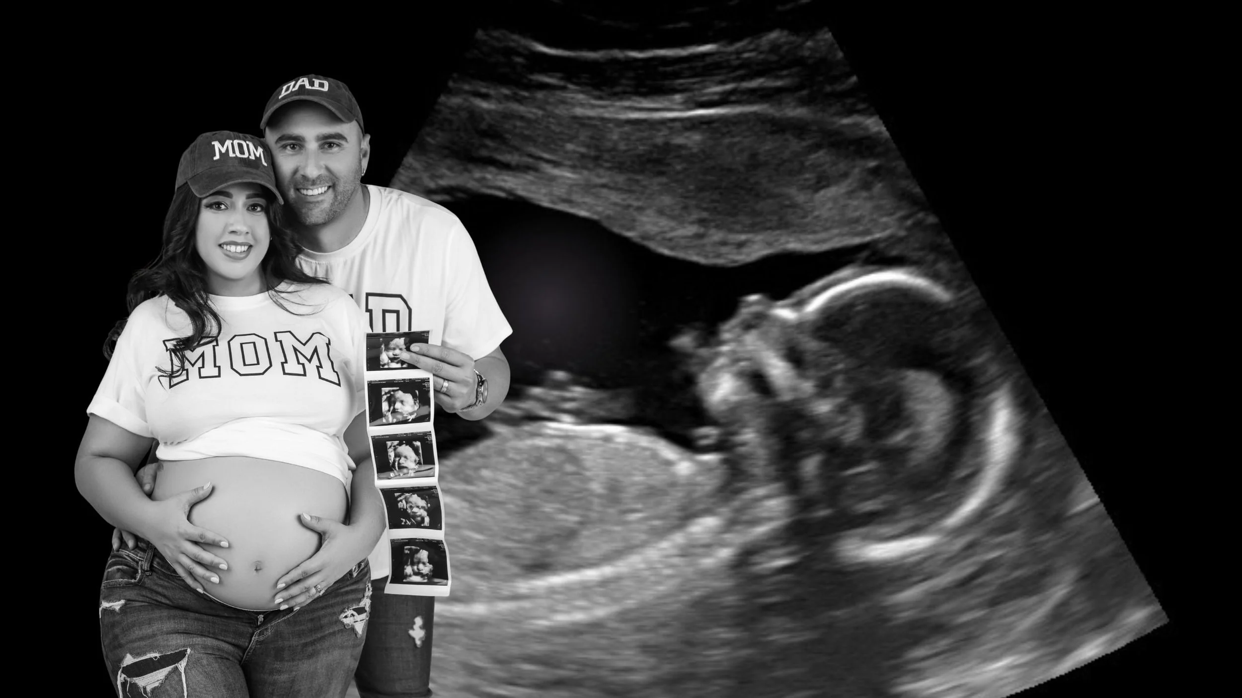 pregnancy-ultrasound-tampa - PREGGOLAND MAMAS