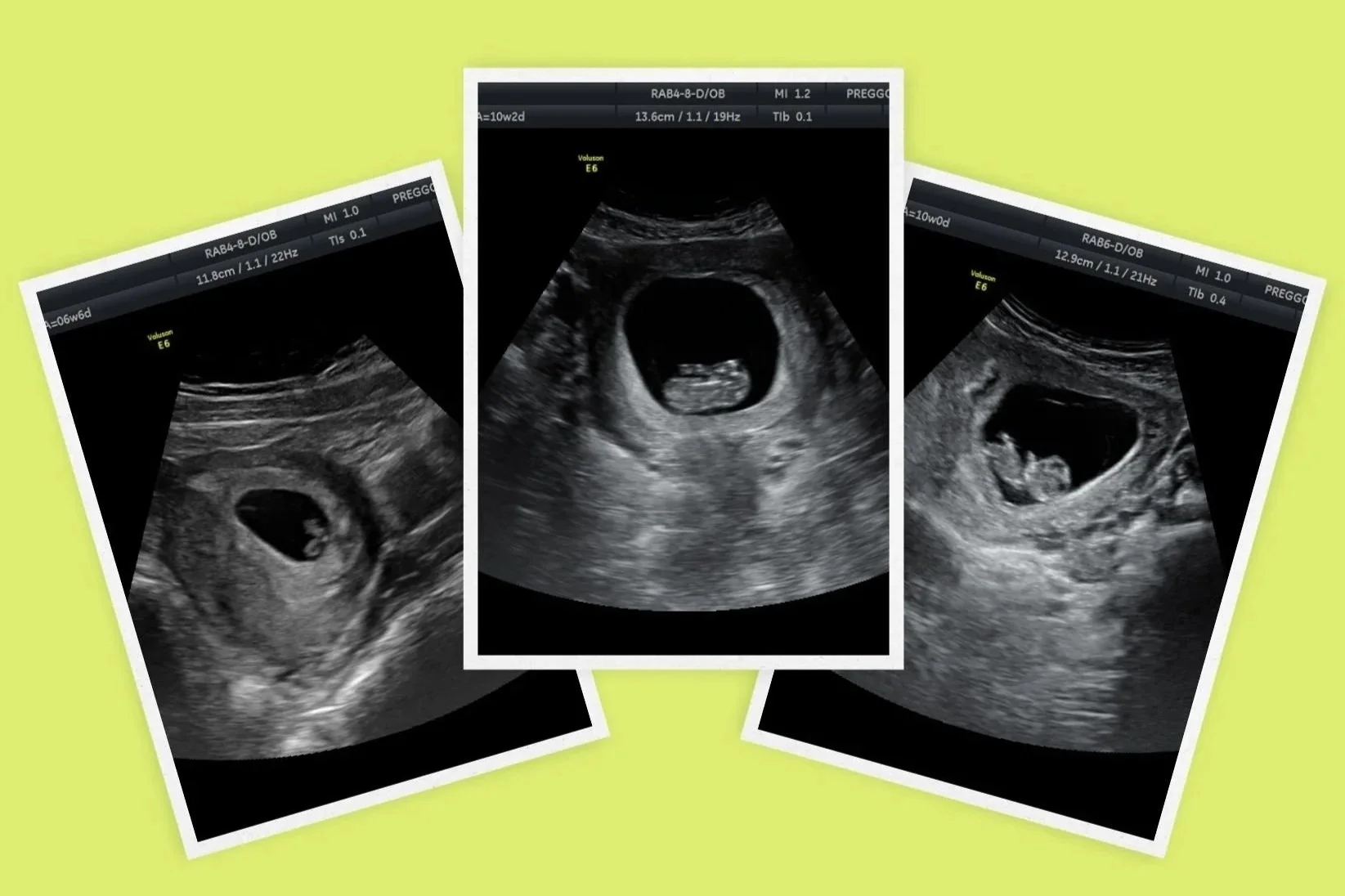 ULTRASONIDO 2D BASICO