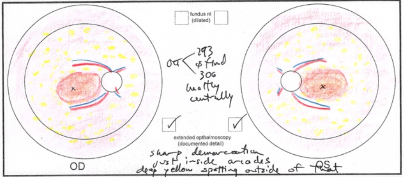 Unknown retinal dystrophy affecting central macula