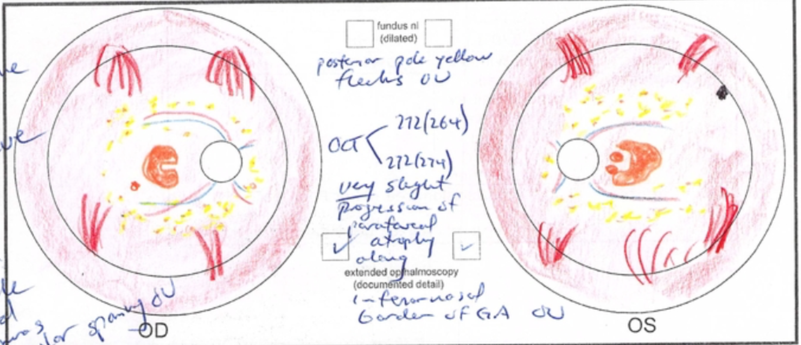 Autosomal recessive retinitis pigmentosa