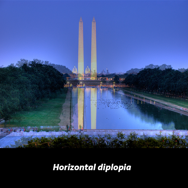 u horizontal diplopia.jpg