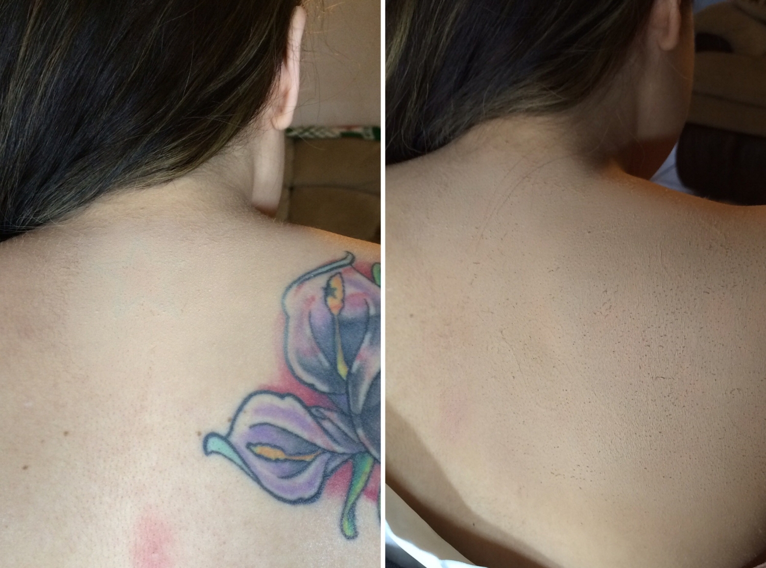 Tattoo Cover-ups — Lisa Pelayo