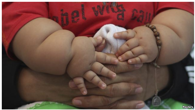 Child obesity pic on 2025 projection of 70 million!.PNG